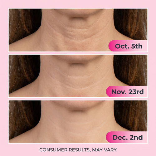 Mehr Active Complex - Unlock Youthful Skin!